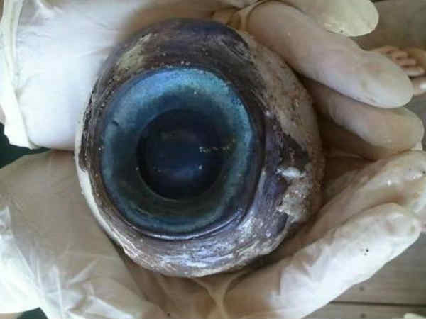 ಕಣ್ಣು