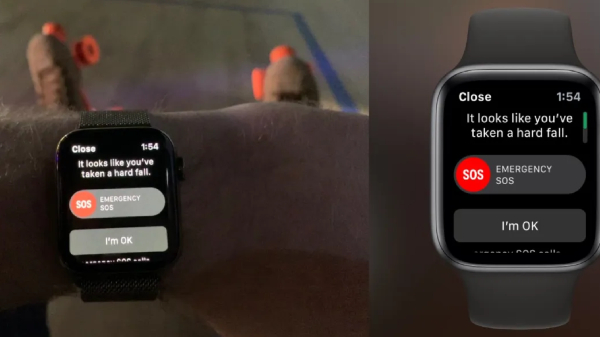 ತಲೆಗೆ ಪೆಟ್ಟಾಗಿ ಗಂಭೀರವಾಗಿದ್ದ ವ್ಯಕ್ತಿಯ ಜೀವ ಉಳಿಸಿದ ಆಪಲ್‌ ವಾಚ್‌! 