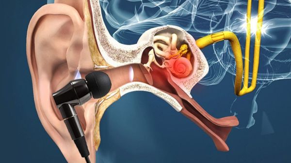 ನೀವು ಯಾವಾಗಲೂ ಇಯರ್‌ಬಡ್ಸ್‌ ಬಳಕೆ ಮಾಡುತ್ತೀರಾ? ಈ ಸಮಸ್ಯೆ ಕಟ್ಟಿಟ್ಟಬುತ್ತಿ!   